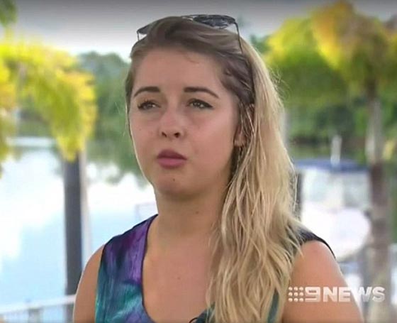  مراهق يحاول إبهار صديقته في رهان فيتعرض لـ (عضة تمساح)! صورة رقم 7