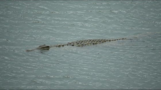  مراهق يحاول إبهار صديقته في رهان فيتعرض لـ (عضة تمساح)! صورة رقم 9