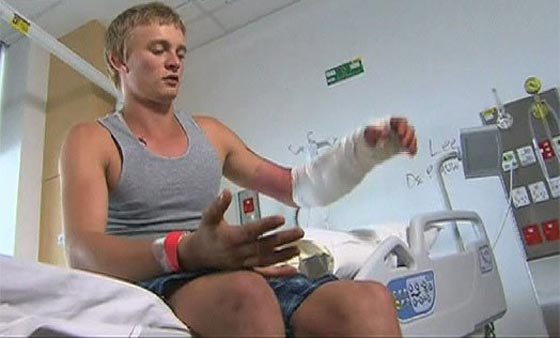  مراهق يحاول إبهار صديقته في رهان فيتعرض لـ (عضة تمساح)! صورة رقم 2