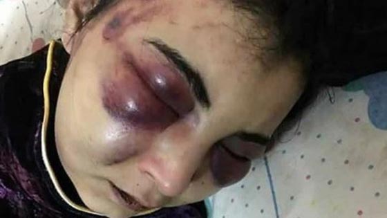 مصري يعتدي على زوجته بوحشية وهمجية بسبب حساب على فيسبوك! صورة رقم 1