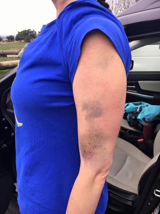 امريكية شجاعة ضربت مغتصبها بكل  شراسة وتحولت الى بطلة شعبية! صورة رقم 6