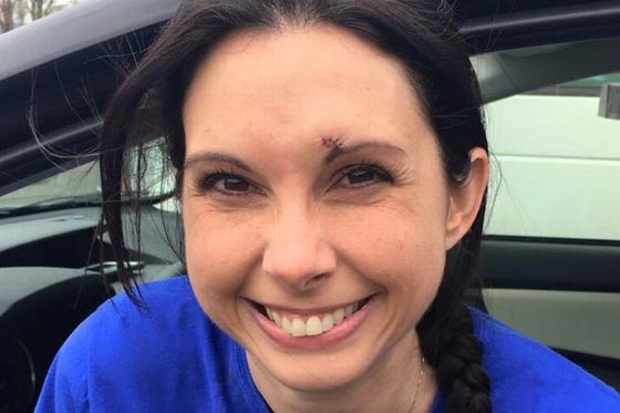 امريكية شجاعة ضربت مغتصبها بكل  شراسة وتحولت الى بطلة شعبية! صورة رقم 4