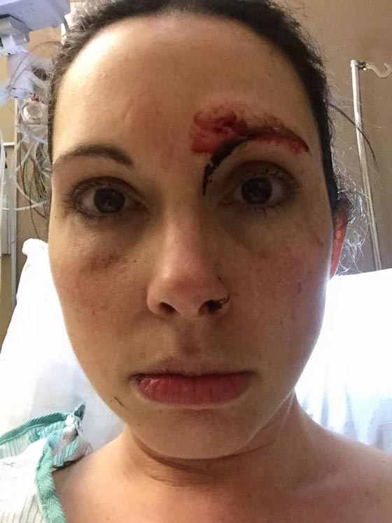 امريكية شجاعة ضربت مغتصبها بكل  شراسة وتحولت الى بطلة شعبية! صورة رقم 10