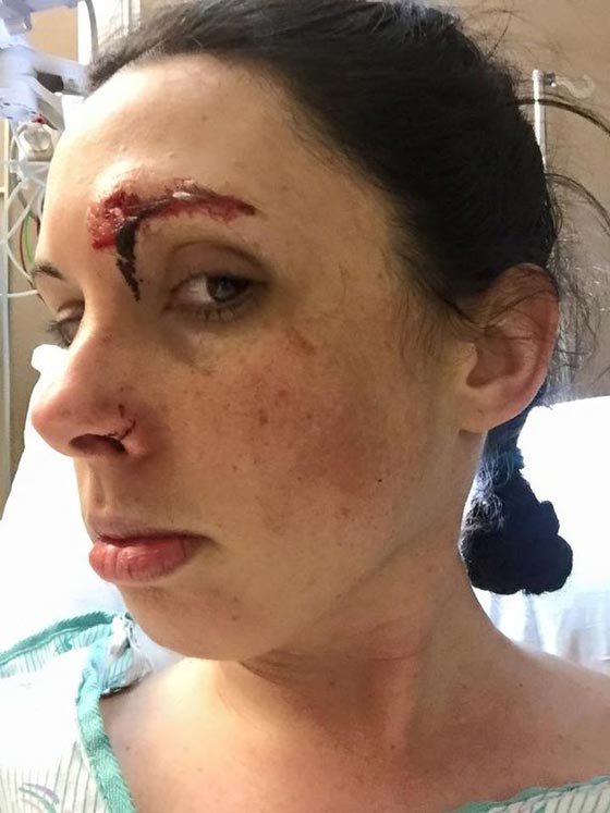 امريكية شجاعة ضربت مغتصبها بكل  شراسة وتحولت الى بطلة شعبية! صورة رقم 1