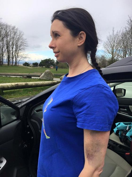 امريكية شجاعة ضربت مغتصبها بكل  شراسة وتحولت الى بطلة شعبية! صورة رقم 11