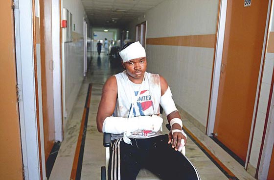 اعتداء وحشي على مجموعة افارقة بعد اتهامهم بأكل طالب! فيديو صورة رقم 2