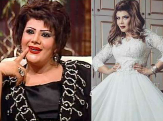 صور فنانين عرب وأجانب عانوا من الوزن الزائد وأصبحوا عنوان الرشاقة  صورة رقم 6