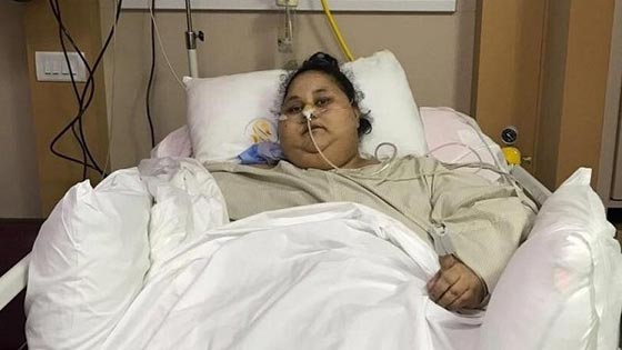  صدمة.. اطباء في الهند يعلنون ان لا علاج لحالة ايمان المصرية! صورة رقم 3