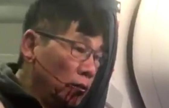 فيديو صادم: اغرب حادثة طرد من الطائرة لطبيب سحلوه وجرجروه وشوهوا وجهه! صورة رقم 2