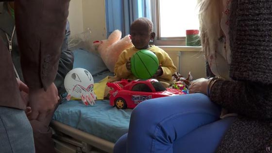  صور صادمة: طفل هندي يتحول الى حجر بسبب مرض نادر! صورة رقم 2