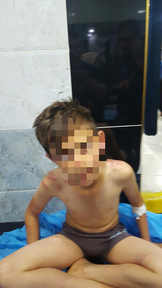 اعتقال مواطن عراقي عذب ابنه الصغير بوحشية شوهت جسده.. صور صورة رقم 1