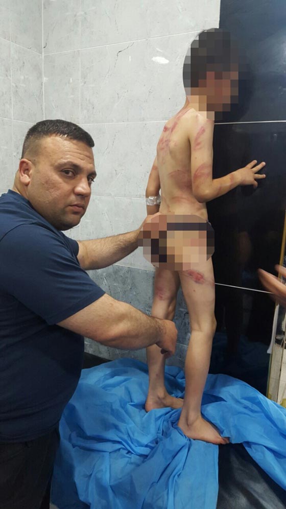 اعتقال مواطن عراقي عذب ابنه الصغير بوحشية شوهت جسده.. صور صورة رقم 2