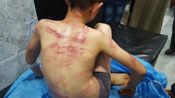 اعتقال مواطن عراقي عذب ابنه الصغير بوحشية شوهت جسده.. صور صورة رقم 4