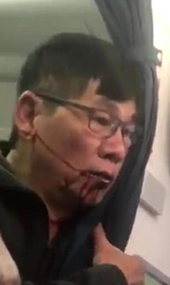 ضربها بعربة أطفال: فيديو فضيحة جديدة على متن طائرة اميريكان إيرلاينز صورة رقم 9