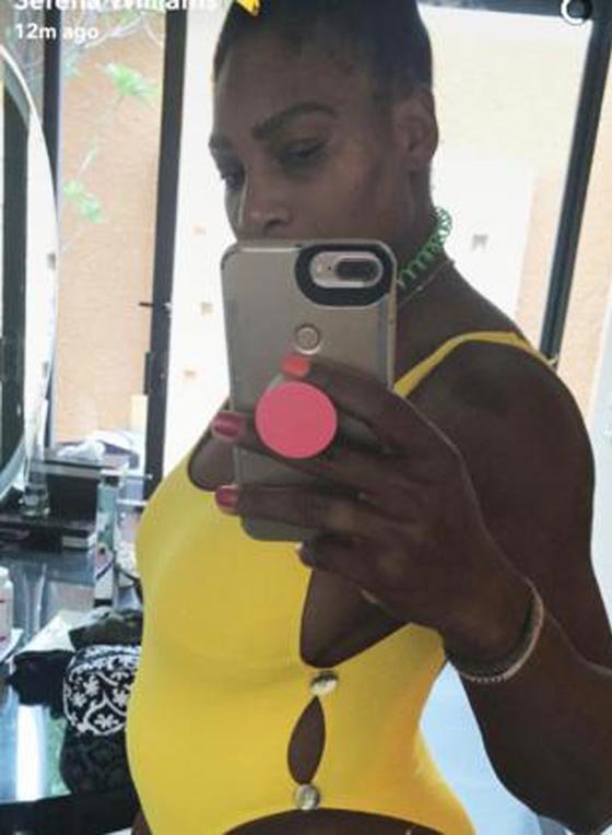 الشوكولاتة بالحليب.. تعليق عنصري سيء عن جنين سيرينا وليامز صورة رقم 3