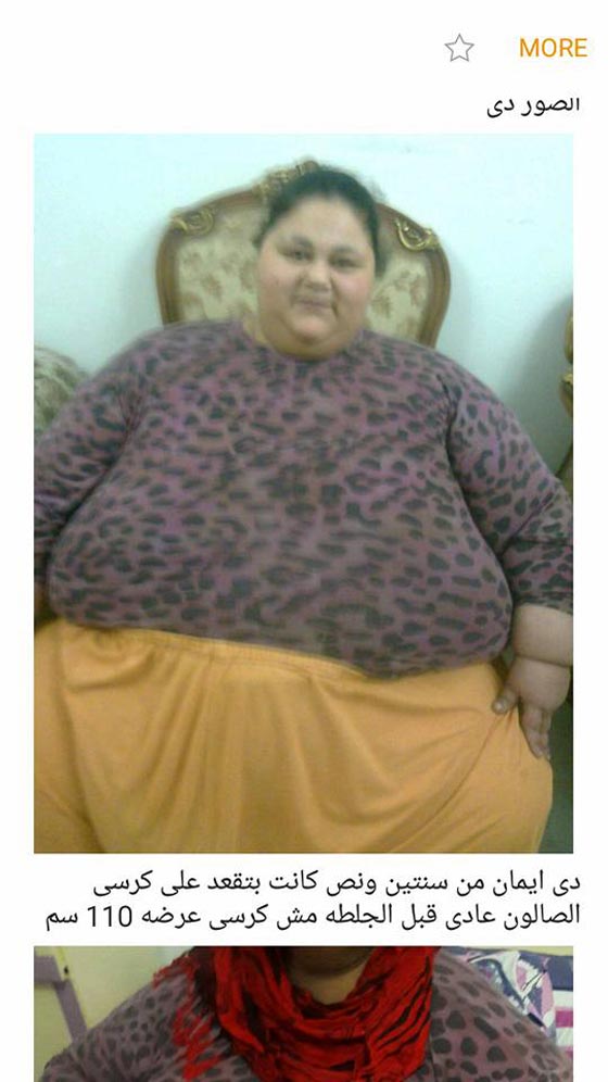 اصابة ايمان المصرية (أثقل امرأة في العالم) بالشلل وشقيقتها تهاجم الطبيب الهندي! صورة رقم 3