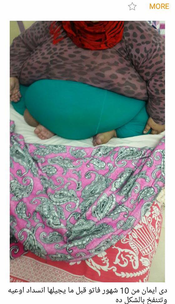 اصابة ايمان المصرية (أثقل امرأة في العالم) بالشلل وشقيقتها تهاجم الطبيب الهندي! صورة رقم 7