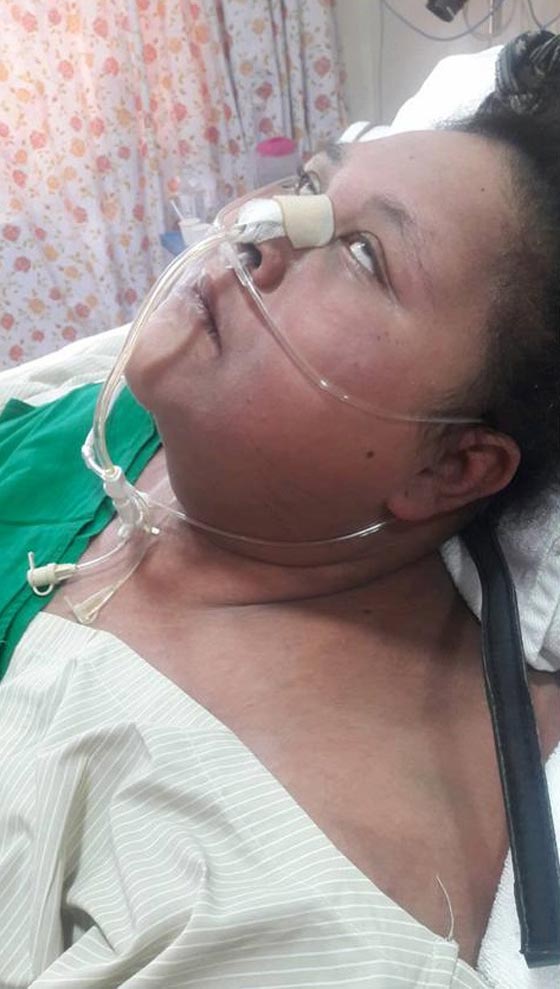 اصابة ايمان المصرية (أثقل امرأة في العالم) بالشلل وشقيقتها تهاجم الطبيب الهندي! صورة رقم 4