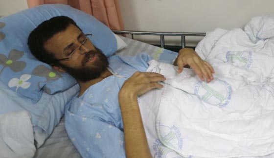 هكذا يبدو الأسير بعد 80 يوماً من الإضراب عن الطعام صورة رقم 2