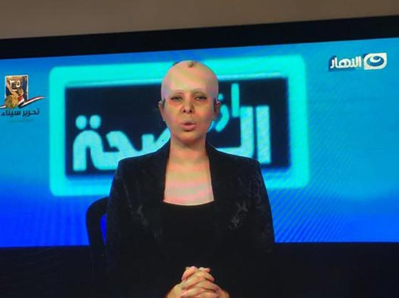 اخرهم  بوسي.. 4 إعلاميين أثاروا الجدل بدعمهم مرضى السرطان صورة رقم 1