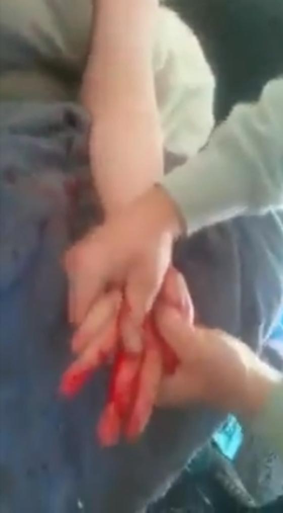 فيديو مروع.. قناص أخطأ بإصابة سيجارة  فنسف أصابع امرأة صورة رقم 4