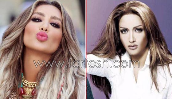 المبالغة في نفخ الشفاه لدى نجمات لبنان.. هل يزيدهن جمالا وتألقا؟! صورة رقم 1