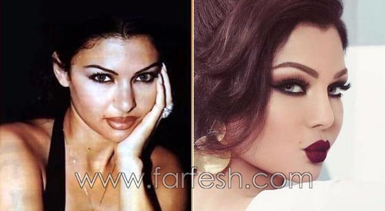 المبالغة في نفخ الشفاه لدى نجمات لبنان.. هل يزيدهن جمالا وتألقا؟! صورة رقم 2