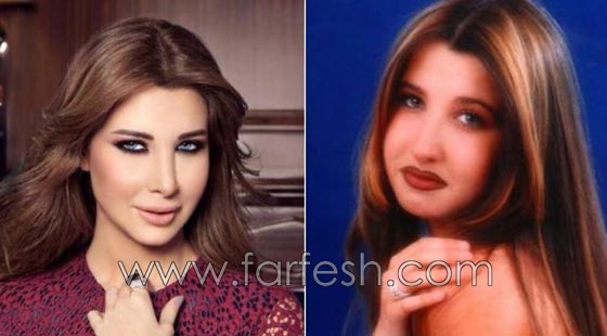 المبالغة في نفخ الشفاه لدى نجمات لبنان.. هل يزيدهن جمالا وتألقا؟! صورة رقم 3