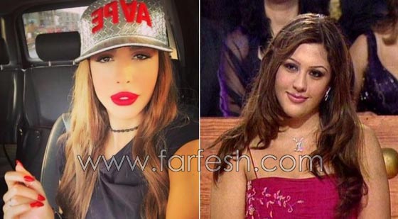 المبالغة في نفخ الشفاه لدى نجمات لبنان.. هل يزيدهن جمالا وتألقا؟! صورة رقم 4