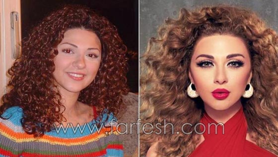المبالغة في نفخ الشفاه لدى نجمات لبنان.. هل يزيدهن جمالا وتألقا؟! صورة رقم 5