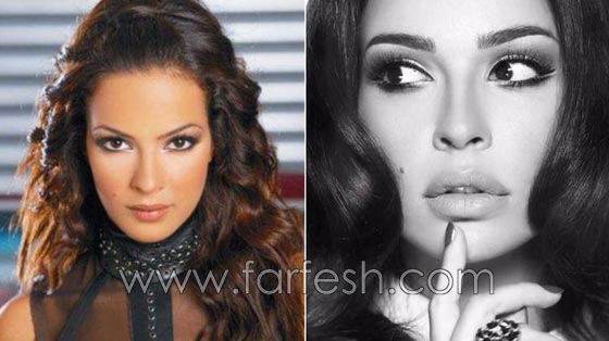 المبالغة في نفخ الشفاه لدى نجمات لبنان.. هل يزيدهن جمالا وتألقا؟! صورة رقم 6