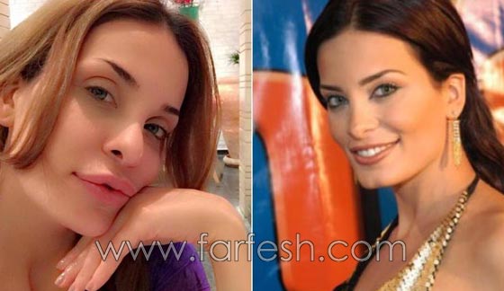 المبالغة في نفخ الشفاه لدى نجمات لبنان.. هل يزيدهن جمالا وتألقا؟! صورة رقم 7