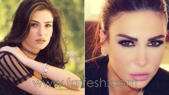 المبالغة في نفخ الشفاه لدى نجمات لبنان.. هل يزيدهن جمالا وتألقا؟! صورة رقم 9