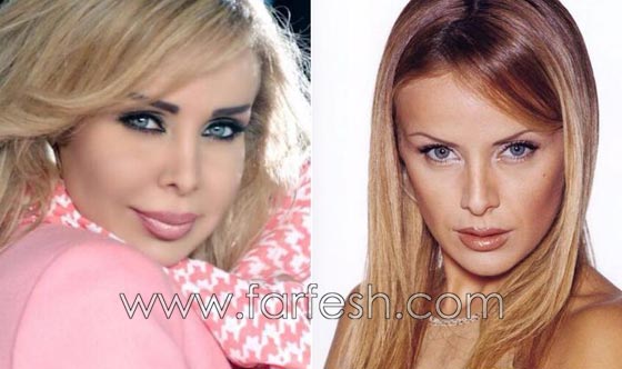 المبالغة في نفخ الشفاه لدى نجمات لبنان.. هل يزيدهن جمالا وتألقا؟! صورة رقم 10