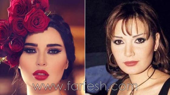 المبالغة في نفخ الشفاه لدى نجمات لبنان.. هل يزيدهن جمالا وتألقا؟! صورة رقم 11