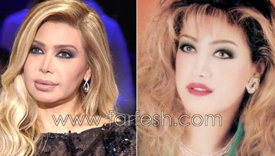 المبالغة في نفخ الشفاه لدى نجمات لبنان.. هل يزيدهن جمالا وتألقا؟! صورة رقم 12
