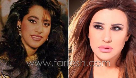 المبالغة في نفخ الشفاه لدى نجمات لبنان.. هل يزيدهن جمالا وتألقا؟! صورة رقم 13