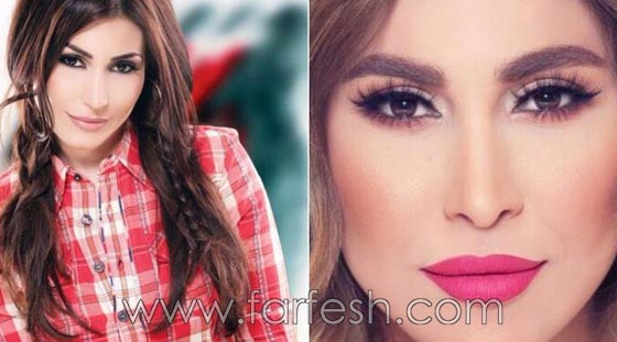 المبالغة في نفخ الشفاه لدى نجمات لبنان.. هل يزيدهن جمالا وتألقا؟! صورة رقم 14