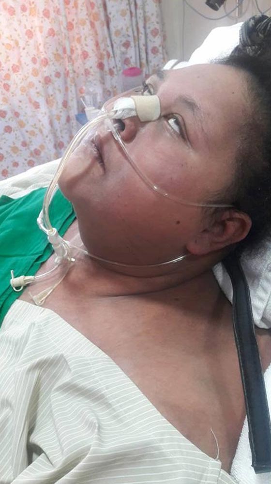 الاطباء يستدعون الشرطة لشقيقة فتاة النصف طن بسبب كوب ماء صورة رقم 6