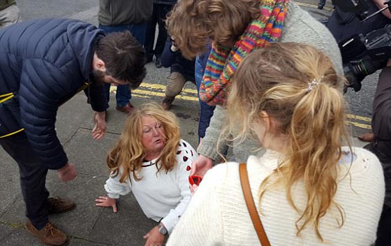  صور صادمة لمشاجرة نسائية دموية عنيفة في بريطانيا: لن تصدّق السبب! صورة رقم 9