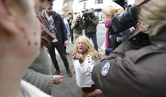  صور صادمة لمشاجرة نسائية دموية عنيفة في بريطانيا: لن تصدّق السبب! صورة رقم 10