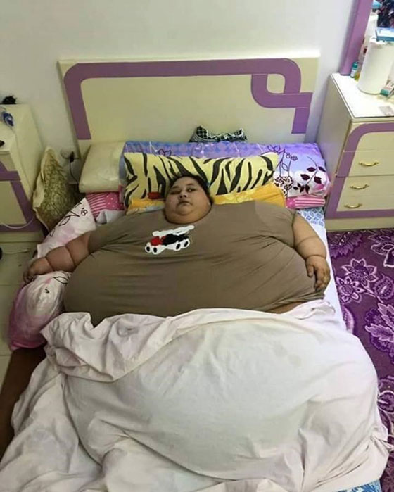 وصول المرأة الاكثر وزنا في العالم الى ابو ظبي لمرحلة ثانية من العلاج صورة رقم 4