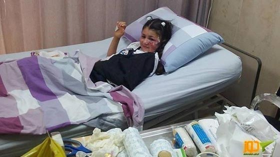 طفلة فلسطينية تسقط من لعبة ملاهي على معلمتين وتنجو باعجوبة.. فيديو صورة رقم 1