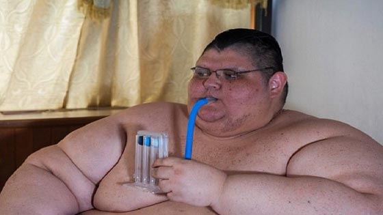  على خطى ايمان المصرية.. اسمن رجل في العالم يبدأ رحلة إنقاص الوزن صورة رقم 1