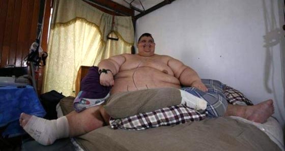  على خطى ايمان المصرية.. اسمن رجل في العالم يبدأ رحلة إنقاص الوزن صورة رقم 5