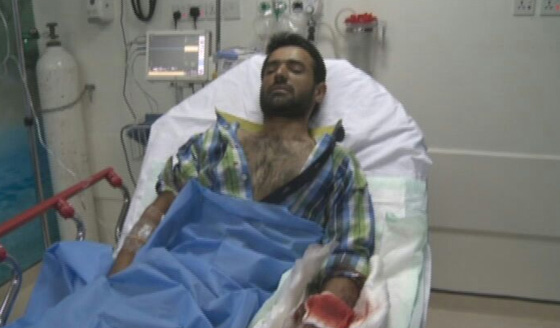  مقتل شخصين بينهم طفل في هجوم ارهابي بالقطيف في السعودية صورة رقم 2