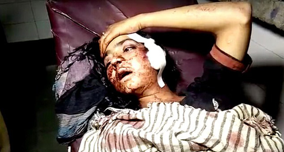 هندية أحبت شابا فأطلق والدها وشقيقها عليها الرصاص لحفظ الشرف.. فيديو وصور صورة رقم 3