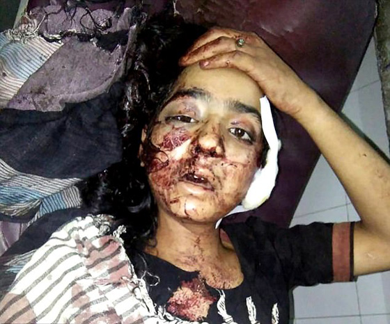 هندية أحبت شابا فأطلق والدها وشقيقها عليها الرصاص لحفظ الشرف.. فيديو وصور صورة رقم 1