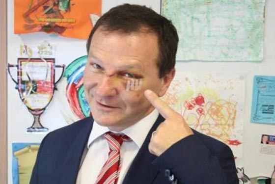 برنامج كوميدي يتسبب بـ 3 قطب في وجه سياسي استرالي صورة رقم 2