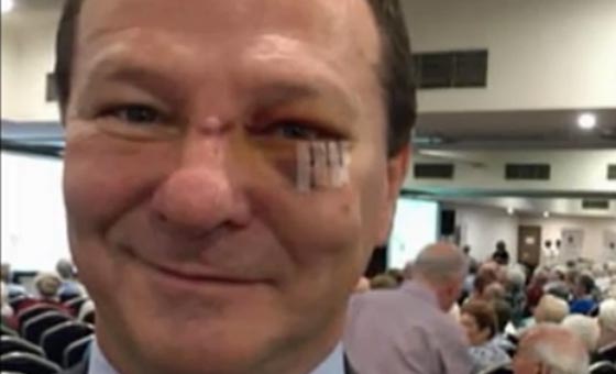 برنامج كوميدي يتسبب بـ 3 قطب في وجه سياسي استرالي صورة رقم 1